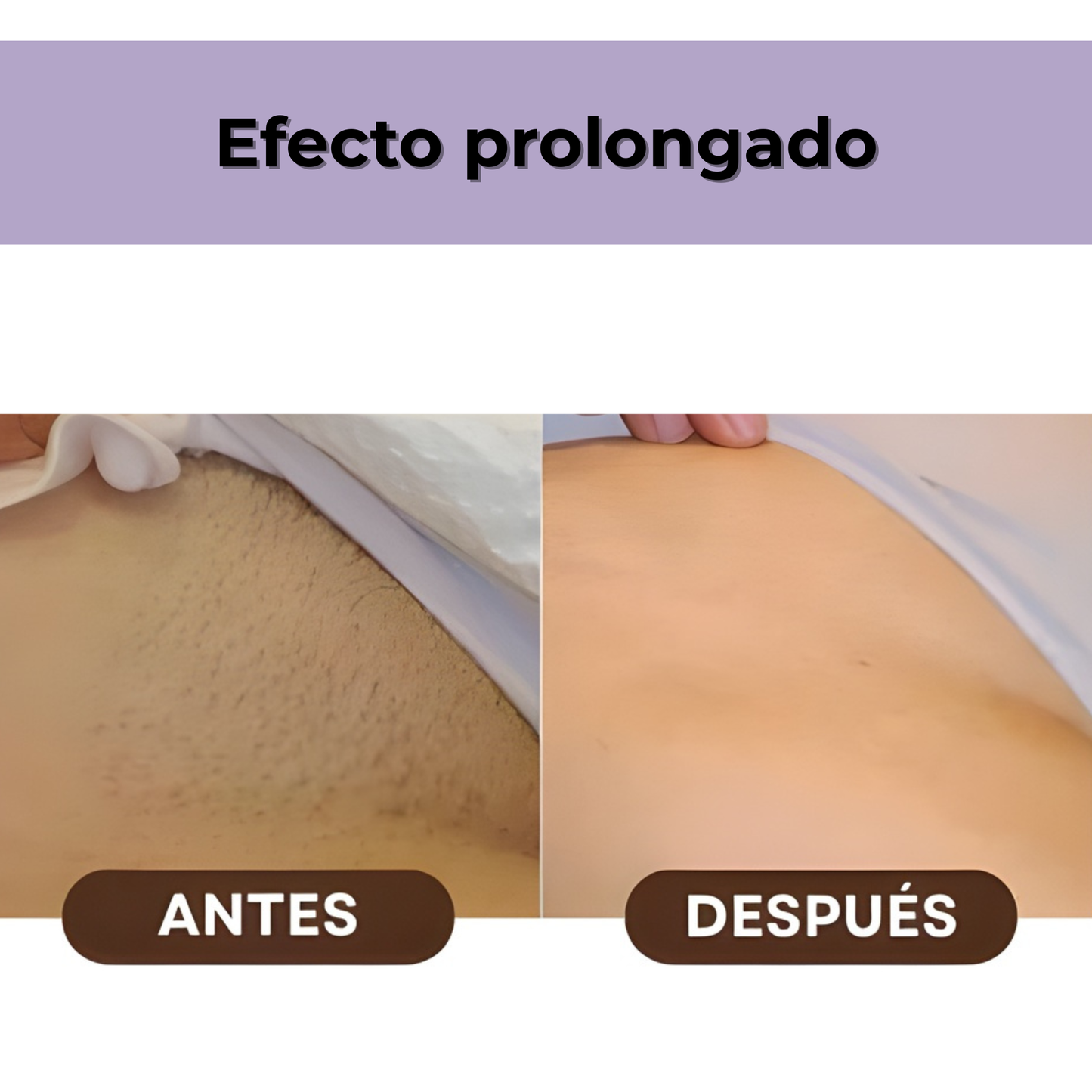 Depiladora láser sin dolor en casa – Depila sin tirones – Piel suave al instante